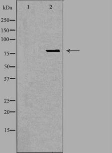OGFR Antibody - Western blot analysis of extracts of HeLa cells using OGFR antibody. The lane on the left is treated with the antigen-specific peptide.