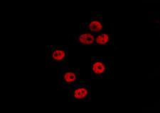 OGFR Antibody - Staining HepG2 cells by IF/ICC. The samples were fixed with PFA and permeabilized in 0.1% Triton X-100, then blocked in 10% serum for 45 min at 25°C. The primary antibody was diluted at 1:200 and incubated with the sample for 1 hour at 37°C. An Alexa Fluor 594 conjugated goat anti-rabbit IgG (H+L) Ab, diluted at 1/600, was used as the secondary antibody.