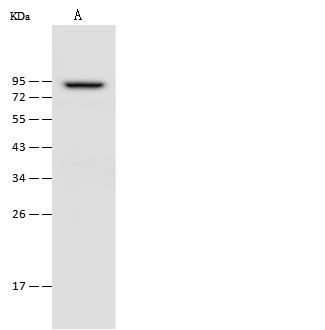 OGFR Antibody - Anti-OGFR rabbit polyclonal antibody at 1:500 dilution. Lane A: HepG2 Whole Cell Lysate. Lysates/proteins at 30 ug per lane. Secondary: Goat Anti-Rabbit IgG (H+L)/HRP at 1/10000 dilution. Developed using the ECL technique. Performed under reducing conditions. Predicted band size: 73 kDa.