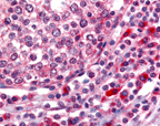 OGG1 Antibody - Tonsil, Germinal Center and Mantle Zone 60x.  This image was taken for the unconjugated form of this product. Other forms have not been tested.