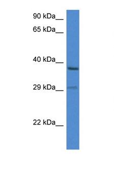 OGG1 Antibody - OGG1 antibody Western blot of ACHN Cell lysate. Antibody concentration 1 ug/ml.  This image was taken for the unconjugated form of this product. Other forms have not been tested.