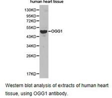 OGG1 Antibody - Western blot.