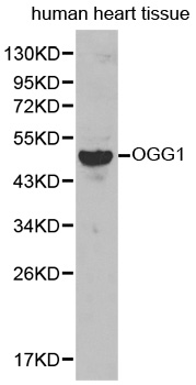 OGG1 Antibody - Western blot analysis of extracts of human heart tissue, using OGG1 antibody.