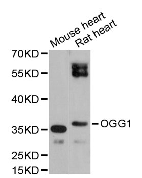OGG1 Antibody - Western blot analysis of extracts of various cell lines, using OGG1 antibody at 1:1000 dilution. The secondary antibody used was an HRP Goat Anti-Rabbit IgG (H+L) at 1:10000 dilution. Lysates were loaded 25ug per lane and 3% nonfat dry milk in TBST was used for blocking. An ECL Kit was used for detection and the exposure time was 90s.