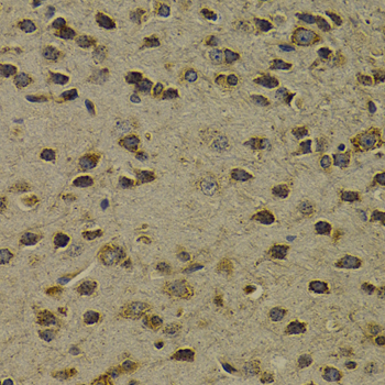 OGG1 Antibody - Immunohistochemistry of paraffin-embedded mouse brain using OGG1 antibodyat dilution of 1:200 (40x lens).