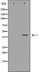OGG1 Antibody - Western blot analysis of extracts of human heart tissue using OGG1 antibody. The lane on the left is treated with the antigen-specific peptide.