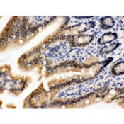 OGT / O-GLCNAC Antibody - OGT antibody IHC-paraffin. IHC(P): Mouse Intestine Tissue.