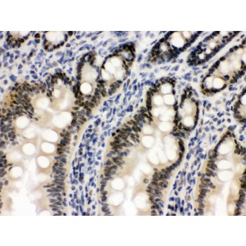 OGT / O-GLCNAC Antibody - OGT antibody IHC-paraffin. IHC(P): Rat Intestine Tissue.