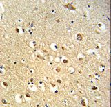 OGT / O-GLCNAC Antibody - Formalin-fixed and paraffin-embedded human brain tissue reacted with OGT Antibody , which was peroxidase-conjugated to the secondary antibody, followed by DAB staining. This data demonstrates the use of this antibody for immunohistochemistry; clinical relevance has not been evaluated.