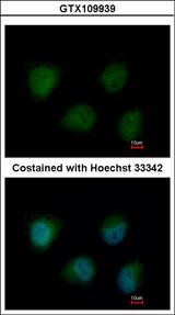 OGT / O-GLCNAC Antibody - Immunofluorescence of paraformaldehyde-fixed HeLa using O-GlcNAc transferase antibody at 1:200 dilution.