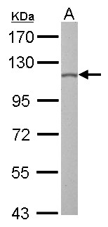 OGT / O-GLCNAC Antibody - O-GlcNAc transferase antibody detects OGT protein by Western blot analysis. A. 30 ug PC-12 whole cell lysate/extract. 7.5 % SDS-PAGE. O-GlcNAc transferase antibody dilution:1:1000