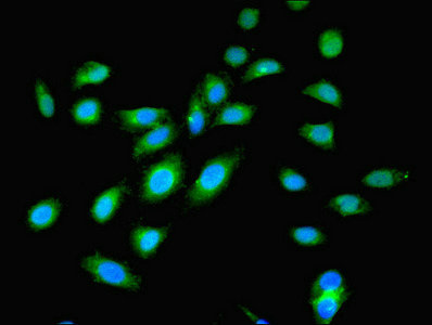 OGT / O-GLCNAC Antibody - Immunofluorescent analysis of Hela cells using OGT Antibody at dilution of 1:100 and Alexa Fluor 488-congugated AffiniPure Goat Anti-Rabbit IgG(H+L)