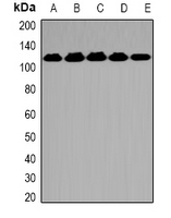 OGT / O-GLCNAC Antibody - Western blot analysis of OGT expression in K562 (A); A549 (B); HeLa (C); mouse spleen (D); mouse brain (E) whole cell lysates.