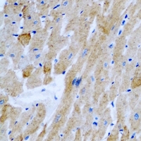 OGT / O-GLCNAC Antibody - Immunohistochemical analysis of OGT staining in rat heart formalin fixed paraffin embedded tissue section. The section was pre-treated using heat mediated antigen retrieval with sodium citrate buffer (pH 6.0). The section was then incubated with the antibody at room temperature and detected using an HRP conjugated compact polymer system. DAB was used as the chromogen. The section was then counterstained with hematoxylin and mounted with DPX.