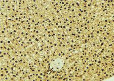 OGT / O-GLCNAC Antibody - 1:100 staining mouse liver tissue by IHC-P. The sample was formaldehyde fixed and a heat mediated antigen retrieval step in citrate buffer was performed. The sample was then blocked and incubated with the antibody for 1.5 hours at 22°C. An HRP conjugated goat anti-rabbit antibody was used as the secondary.