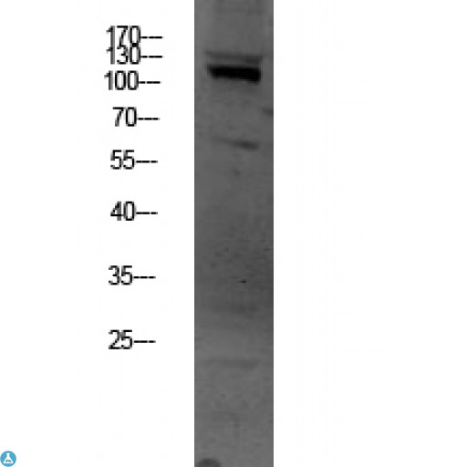 OGT / O-GLCNAC Antibody - Western blot analysis of HEPG2 lysate, antibody was diluted at 1000. Secondary antibody was diluted at 1:20000.