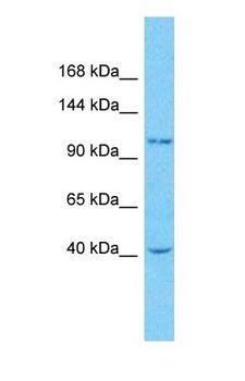 OGT / O-GLCNAC Antibody - Western blot of OGT Antibody with human MDA-MB-435s Whole Cell lysate.  This image was taken for the unconjugated form of this product. Other forms have not been tested.