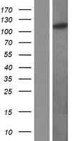 OGT / O-GLCNAC Protein - Western validation with an anti-DDK antibody * L: Control HEK293 lysate R: Over-expression lysate