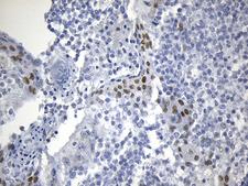 OIP5 Antibody - Immunohistochemical staining of paraffin-embedded Human tonsil within the normal limits using anti-OIP5 mouse monoclonal antibody. (Heat-induced epitope retrieval by 1mM EDTA in 10mM Tris buffer. (pH8.5) at 120°C for 3 min. (1:150)