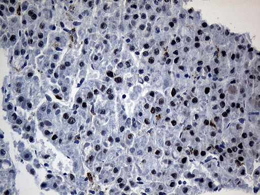 OIP5 Antibody - Immunohistochemical staining of paraffin-embedded Human liver tissue within the normal limits using anti-OIP5 mouse monoclonal antibody. (Heat-induced epitope retrieval by 1mM EDTA in 10mM Tris buffer. (pH8.5) at 120°C for 3 min. (1:500)