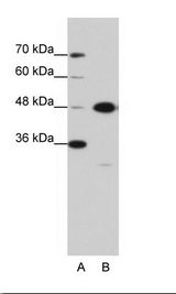OLA1 Antibody - A: Marker, B: Jurkat Cell Lysate.  This image was taken for the unconjugated form of this product. Other forms have not been tested.