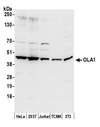 OLA1 Antibody - Detection of human and mouse OLA1 by western blot. Samples: Whole cell lysate (50 µg) from HeLa, HEK293T, Jurkat, mouse TCMK-1, and mouse NIH 3T3 cells prepared using NETN lysis buffer. Antibody: Affinity purified rabbit anti-OLA1 antibody used for WB at 0.1 µg/ml. Detection: Chemiluminescence with an exposure time of 10 seconds.