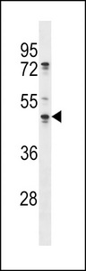 OLA1 Antibody - OLA1 Antibody western blot of A375 cell line lysates (35 ug/lane). The OLA1 antibody detected the OLA1 protein (arrow).