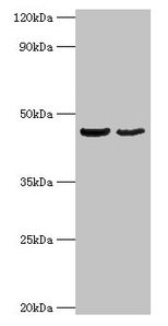 OLA1 Antibody - Western blot All lanes: Obg-like ATPase 1 antibody at 2µg/ml Lane 1: HepG2 whole cell lysate Lane 2: Mouse stomach tissue Secondary Goat polyclonal to rabbit IgG at 1/10000 dilution Predicted band size: 45, 28, 32 kDa Observed band size: 45 kDa