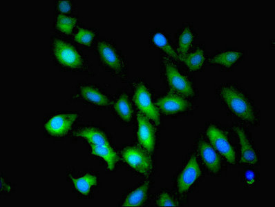 OLA1 Antibody - Immunofluorescent analysis of Hela cells using OLA1 Antibody at dilution of 1:100 and Alexa Fluor 488-congugated AffiniPure Goat Anti-Rabbit IgG(H+L)