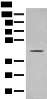 OLA1 Antibody - Western blot analysis of A375 cell lysate  using OLA1 Polyclonal Antibody at dilution of 1:400