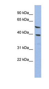 OLAH Antibody - OLAH antibody Western blot of HT1080 cell lysate. This image was taken for the unconjugated form of this product. Other forms have not been tested.