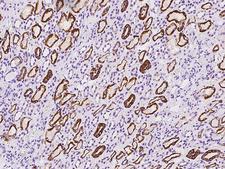 OLAH Antibody - Immunochemical staining of human OLAH in human kidney with rabbit polyclonal antibody at 1:100 dilution, formalin-fixed paraffin embedded sections.