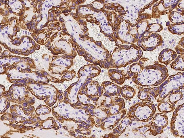 OLAH Antibody - Immunochemical staining of human OLAH in human placenta with rabbit polyclonal antibody at 1:100 dilution, formalin-fixed paraffin embedded sections.
