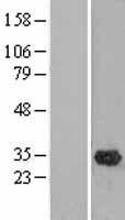 OLAH Protein - Western validation with an anti-DDK antibody * L: Control HEK293 lysate R: Over-expression lysate