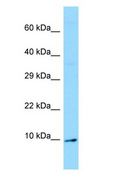 OLFM1 Antibody - AMY / OLFM1 antibody Western Blot of Fetal kidney.  This image was taken for the unconjugated form of this product. Other forms have not been tested.