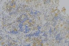 OLFM1 Antibody - 1:100 staining human lymph node tissue by IHC-P. The sample was formaldehyde fixed and a heat mediated antigen retrieval step in citrate buffer was performed. The sample was then blocked and incubated with the antibody for 1.5 hours at 22°C. An HRP conjugated goat anti-rabbit antibody was used as the secondary.