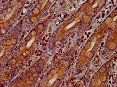 OLFM4 / Olfactomedin 4 Antibody - Immunohistochemistry image at a dilution of 1:300 and staining in paraffin-embedded human small intestine tissue performed on a Leica BondTM system. After dewaxing and hydration, antigen retrieval was mediated by high pressure in a citrate buffer (pH 6.0) . Section was blocked with 10% normal goat serum 30min at RT. Then primary antibody (1% BSA) was incubated at 4 °C overnight. The primary is detected by a biotinylated secondary antibody and visualized using an HRP conjugated SP system.