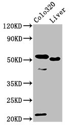 OLFM4 / Olfactomedin 4 Antibody - Positive Western Blot detected in Colo320 whole cell lysate, Rat liver tissue. All lanes: OLFM4 antibody at 10 µg/ml Secondary Goat polyclonal to rabbit IgG at 1/50000 dilution. Predicted band size: 58 KDa. Observed band size: 58 KDa