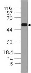 OLFM4 / Olfactomedin 4 Antibody - Fig-1: Western blot analysis of Olfactomedin-4. Anti-Olfactomedin-4 antibody was used at 2 µg/ml on h Stomach lysate.