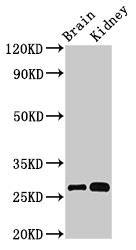 OLFML2B Antibody - Western Blot Positive WB detected in: Mouse brain tissue, Mouse kidney tissue All lanes: OLFML2B antibody at 3µg/ml Secondary Goat polyclonal to rabbit IgG at 1/50000 dilution Predicted band size: 84, 28 kDa Observed band size: 28 kDa