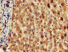 OLFML3 Antibody - Immunohistochemistry of paraffin-embedded human liver tissue at dilution of 1:100