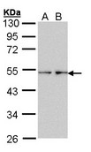 Olfr73 Antibody - Sample (30 ug of whole cell lysate). A: HeLa, B: Hep G2 . 7.5% SDS PAGE. OLFR73 antibody diluted at 1:1000