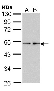 Olfr73 Antibody - Sample (30 ug of whole cell lysate). A: HeLa, B: Hep G2 . 7.5% SDS PAGE. OLFR73 antibody diluted at 1:1000