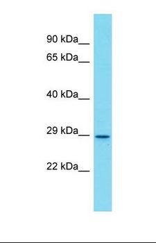 Olfr872 Antibody - Western blot of Mouse Spleen. Olfr872 antibody dilution 1.0 ug/ml.  This image was taken for the unconjugated form of this product. Other forms have not been tested.