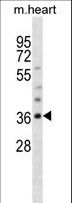 OLIG1 Antibody - OLIG1 Antibody western blot of mouse heart tissue lysates (35 ug/lane). The OLIG1 antibody detected the OLIG1 protein (arrow).