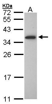 OLIG1 Antibody - Sample (30 ug of whole cell lysate). A: Molt-4. 12% SDS PAGE. OLIG1 antibody diluted at 1:1000