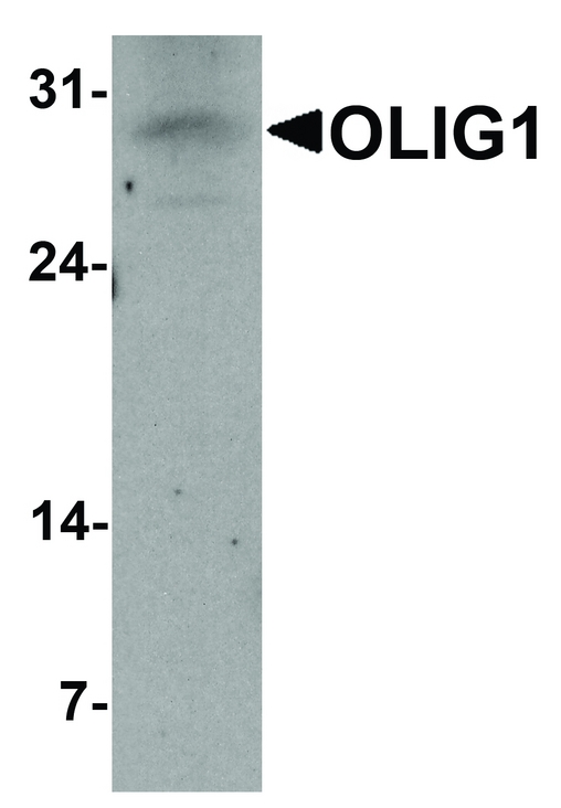 OLIG1 Antibody - Western blot analysis of OLIG1 in A549 cell lysate with OLIG1 antibody at 1 ug/ml.
