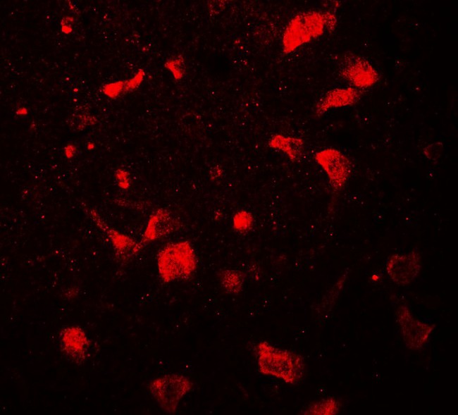 OLIG1 Antibody - Immunofluorescence of OLIG1 in human brain tissue with OLIG1 antibody at 20 ug/mL.