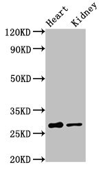 OLIG1 Antibody - Positive Western Blot detected in Rat heart tissue, Rat kidney tissue. All lanes: OLIG1 antibody at 3.2 µg/ml Secondary Goat polyclonal to rabbit IgG at 1/50000 dilution. Predicted band size: 28 KDa. Observed band size: 28 KDa