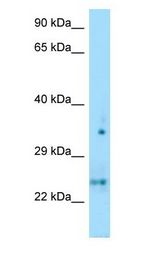 OLIG1 Antibody - OLIG1 antibody Western Blot of Fetal Thymus.  This image was taken for the unconjugated form of this product. Other forms have not been tested.